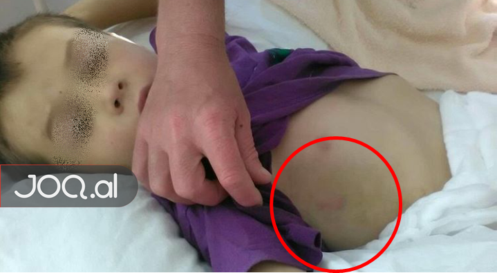 E pickoi gjarpri në arë, familjari: Mirë që u ndodh një makinë se s’do e kishim më djalin