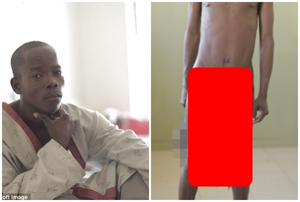 Flet djali me penisin më të madh në botë: Është një tmerr nuk bëj dot asgjë