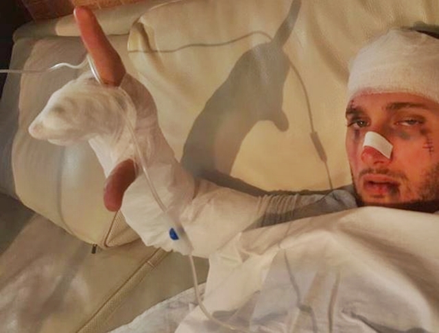 I dëmtuar rëndë dhe i mbështjellë i gjithi me fashë, Florjani tmerron fansat me foton nga spitali