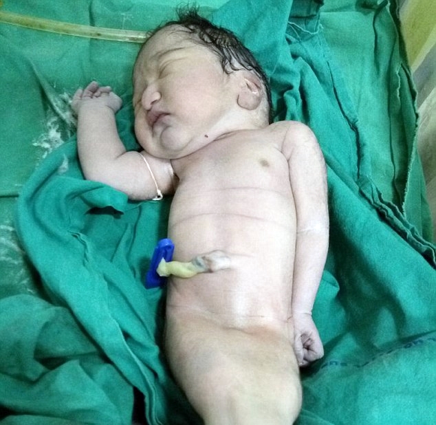 Lind fëmija-sirenë, ka edhe bisht edhe këmbë