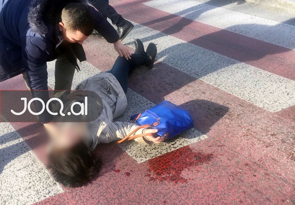 Makina ngre në ajër këmbësoren, aksident i rëndë në Tiranë