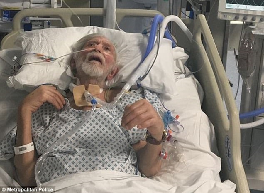 E bënë për koma pasi e rrahën, fëmijët e të moshuarit publikojnë foton drithëruese