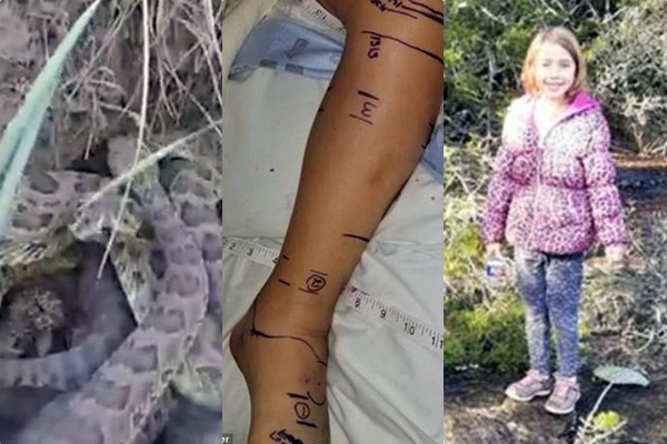 Ra në folenë e gjarprinjëve, helmi i tyre i shkon deri në bark vajzës