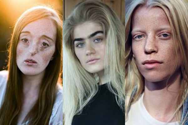 Vajza mos vraponi të fryni buzët, këto modele dikur ishin të shëmtuara por sot jo