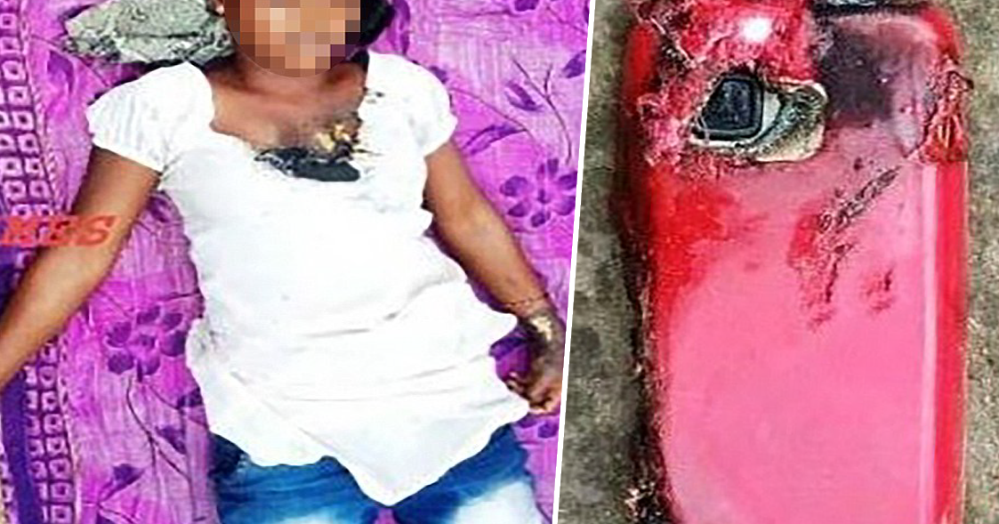 I shpërthen celulari teksa po fliste, vajza nuk çohet më në këmbë