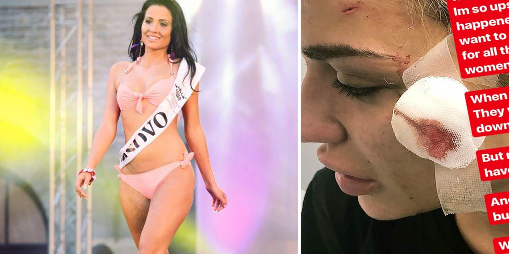 Bëri “të vdekur” këngëtaren shqiptare, kush është modelja-bishë që s’i del njeri para?