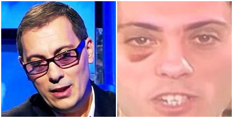 Komplimentoi një vajzë nga publiku, i dashuri i saj gangster i nxiu syrin Adi Krastës