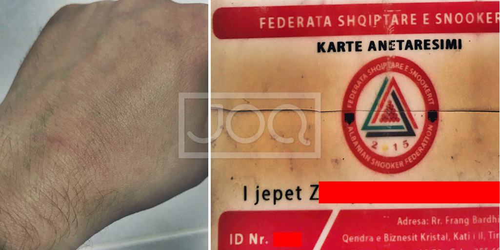 Pistoletën në kokë e 8 orë në polici, profesionistit tonë të bilardos i nxjerrin qumështin e nënës