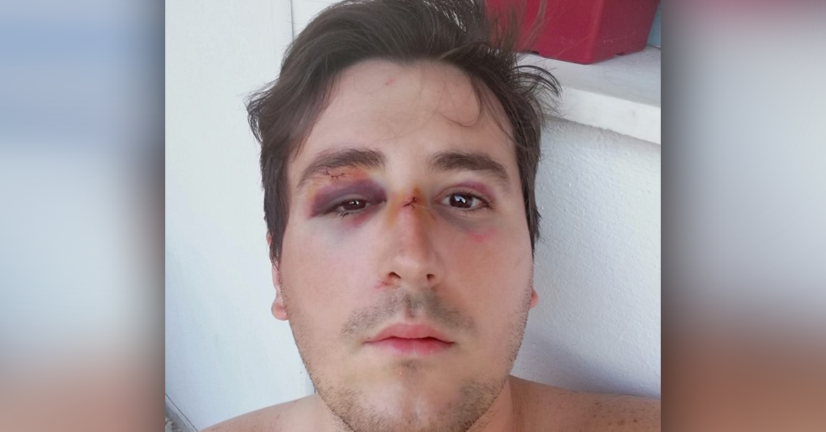 Ish-nënkryetari i FRESSH rrihet me doreza hekuri, çfarë i ndodhi në mesnatë