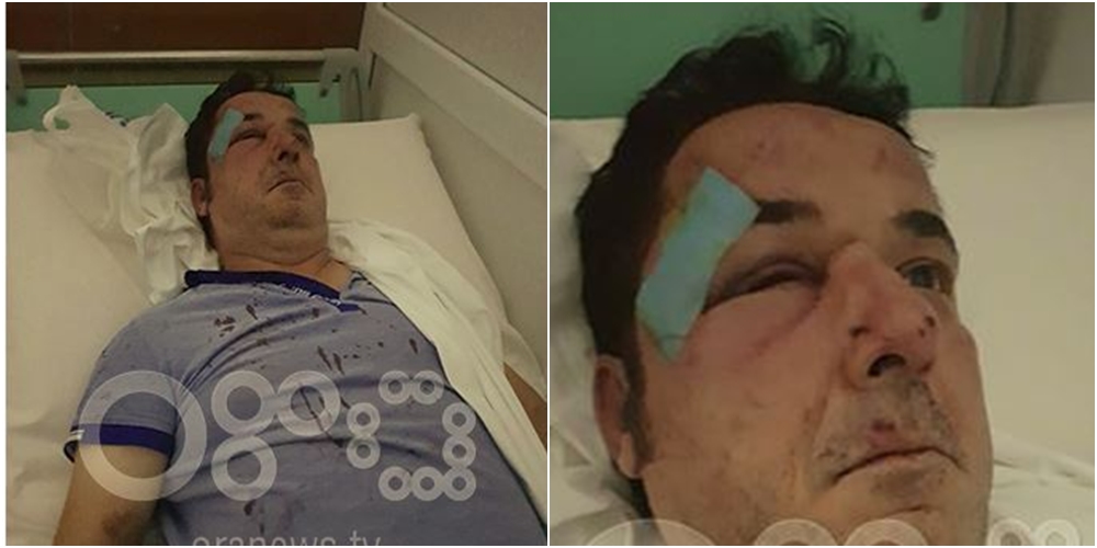 Dhunohet biznesmeni pranë banesës së tij tek Komuna e Parisit në Tiranë