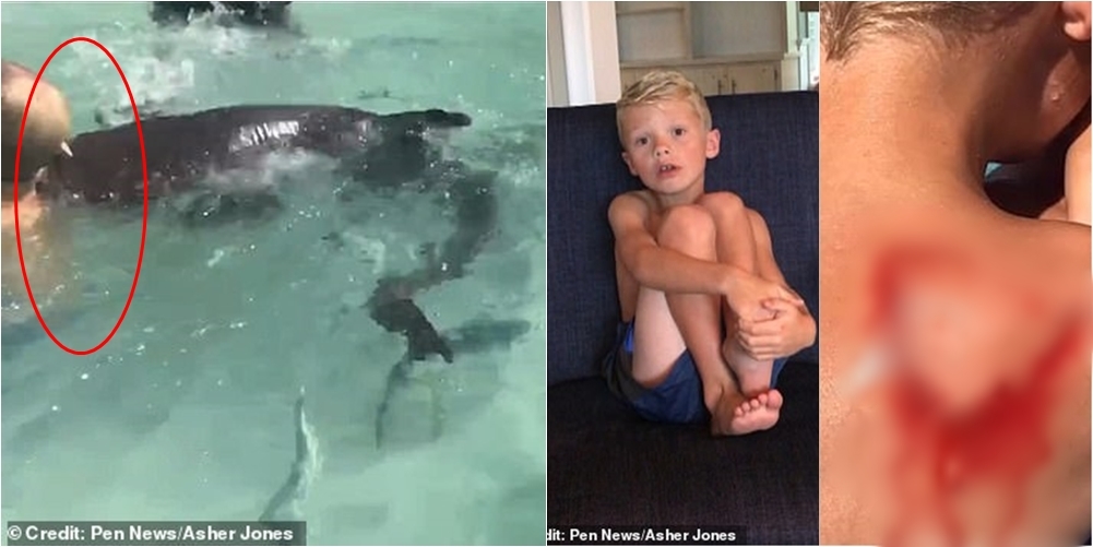 Mendohej se ishin të “urtë”, ky është momenti kur 8-vjeçari kafshohet nga një peshkaqen