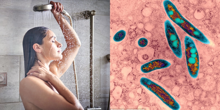 Pisllëku në kokën e dushit është i “gjallë”, këto janë bakteret e tmerrshme që “jetojnë” në banjën tuaj