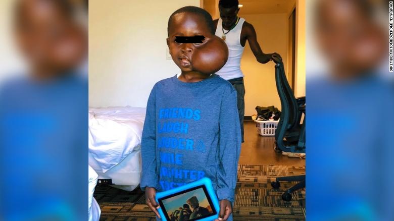 Nuk ia doli dot, 8-vjeçari me tumorin e rrallë ndërron jetë gjatë operacionit