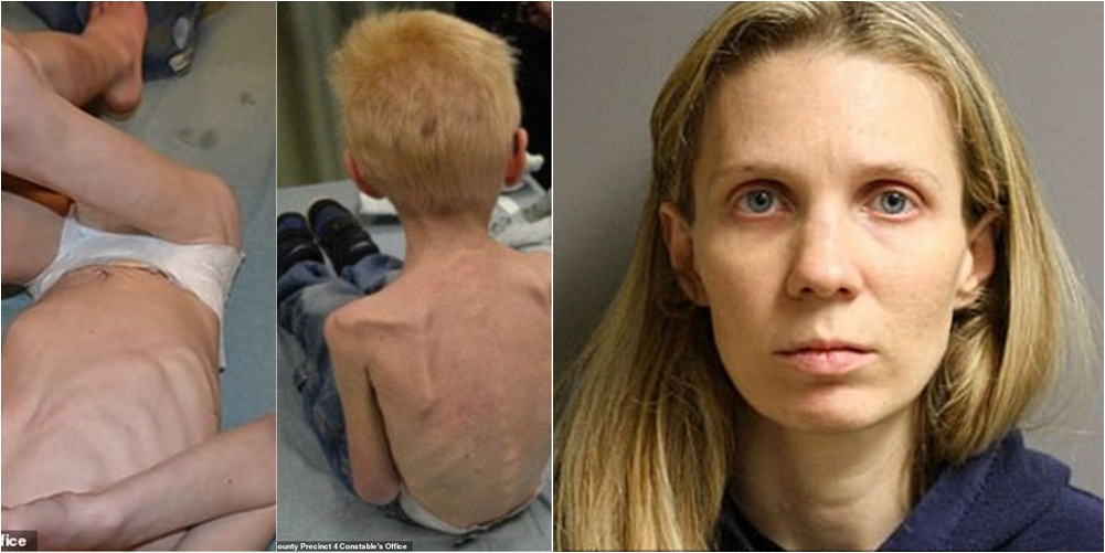 E mbante të mbyllur dhe pa ngrënë, 5-vjeçari bëhet kockë e lëkurë nga keqtrajtimet e njerkës