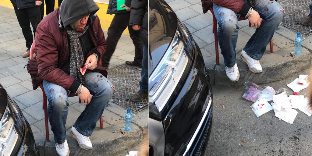 Grabitet dhe dhunohet kambisti në Tiranë, shumë pranë Komisariatit të Policisë