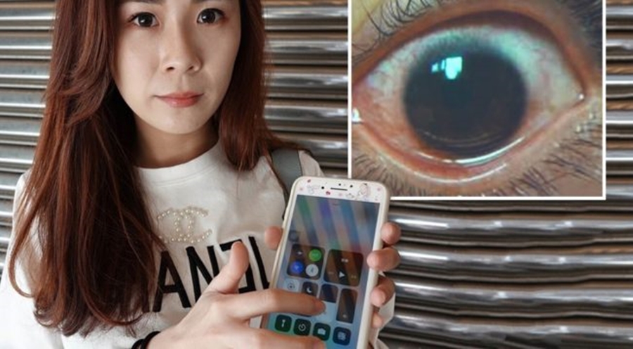 E përdorte celularin në mënyrën e gabuar, 25-vjeçares i krijohen 500 vrima në sy