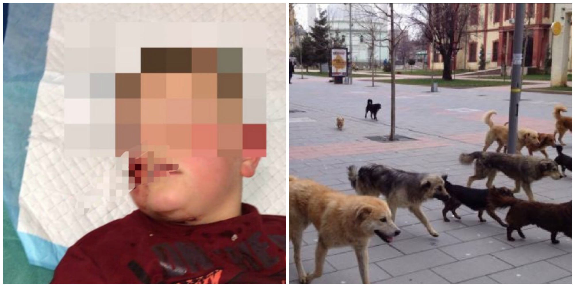 8 vjeçin nga Kosova e lëndojnë në fytyrë qentë endacak