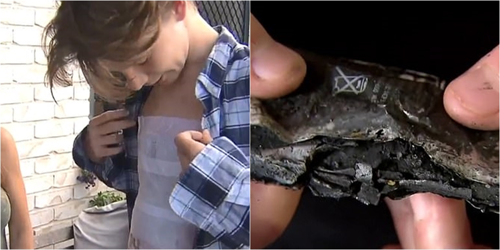 Për pak sa nuk u verbua, adoleshentit i shpërthen bateria e iPhone në duar