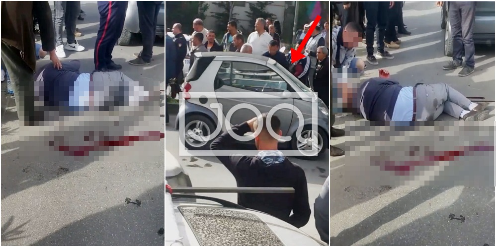 “Ia përplasi kokën te disku i makinës, sepse shoferja po shihte telefonin”, aksident i rëndë në Tiranë