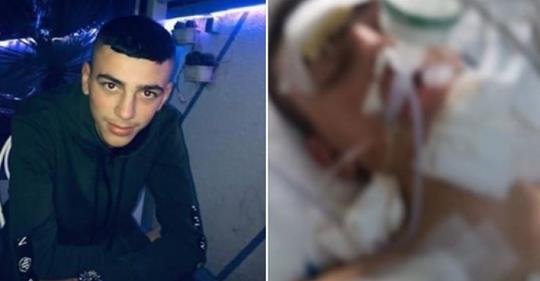 Dalin fotot/ 17-vjeçari që përplasi Mira Kazhani është në gjendje kome në spital