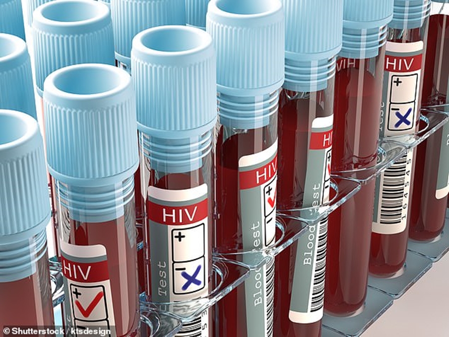Fundi i SIDA-s? Kërkuesit zbulojnë medikamentin që mund t’i japë fund sëmundjes vdekjeprurëse