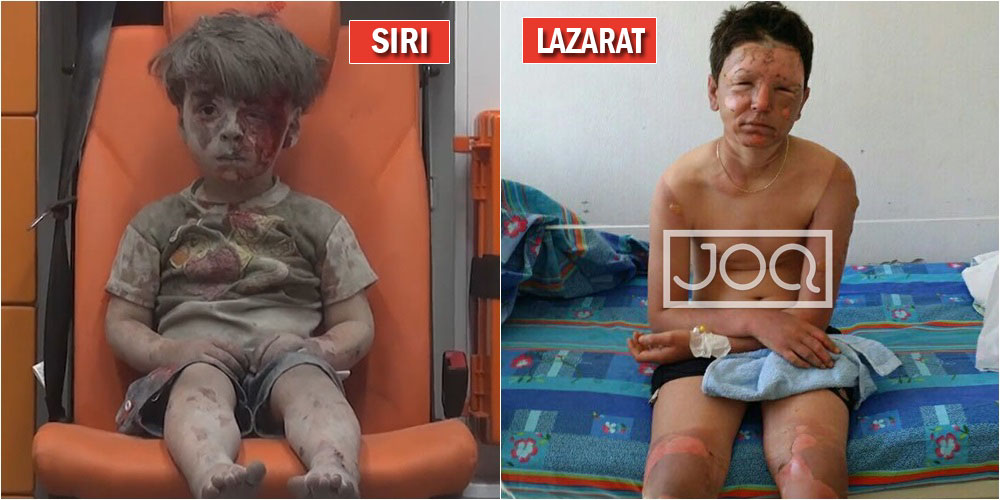 “Kush u dhunua më keq, siriani nga lufta apo djali im nga baruti i policisë në Lazarat?”