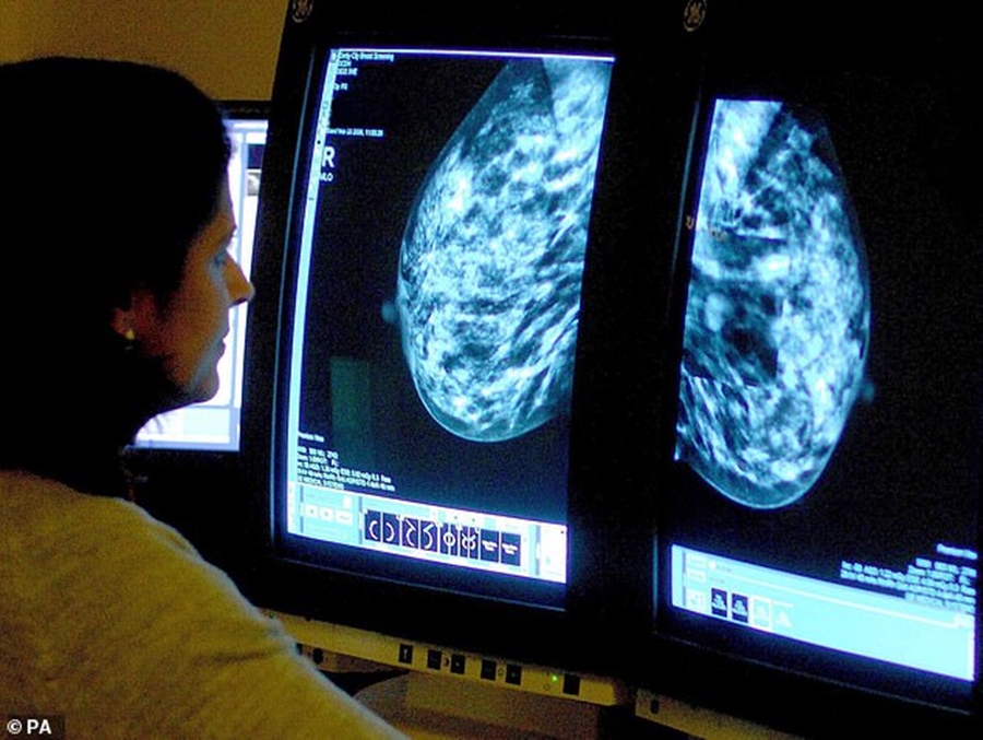 Kanceri i gjirit, zbulohet pilula “magjike” që sjell shpresë për gratë e sëmura