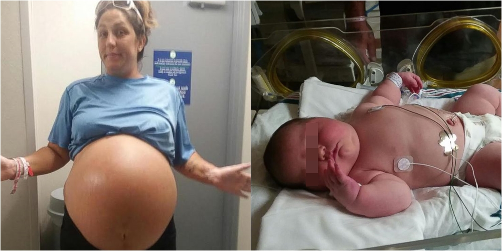 Mendonte se kishte binjakë, nëna sjell në jetë vajzën që peshon 6 kg: Ajo është kaq e madhe