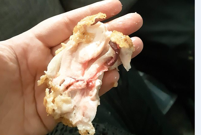 E kishte blerë tek KFC-ja, e reja helmohet dhe përfundon me infeksion në zorrë pasi konsumoi mishin e pulës