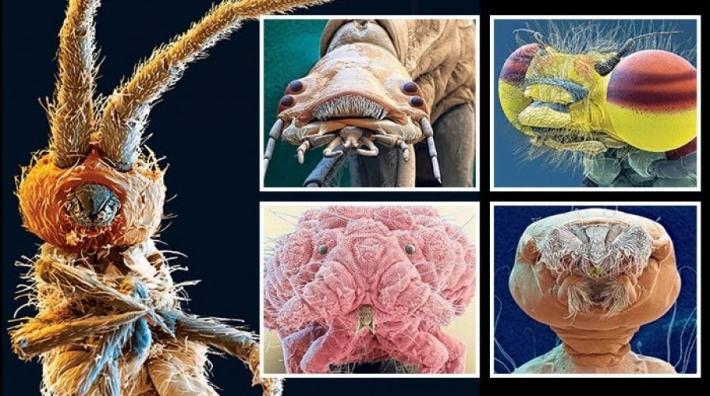 Pamje të frikshme, ja si duken bakteret dhe viruset në mikroskop