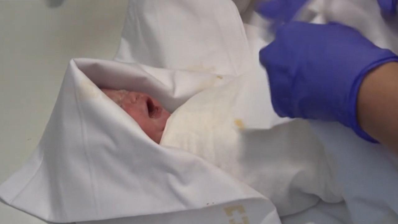 Nëna mbahej gjallë me aparatura, foshnja lind e shëndetshme 117 ditë pas ngjarjes së rëndë