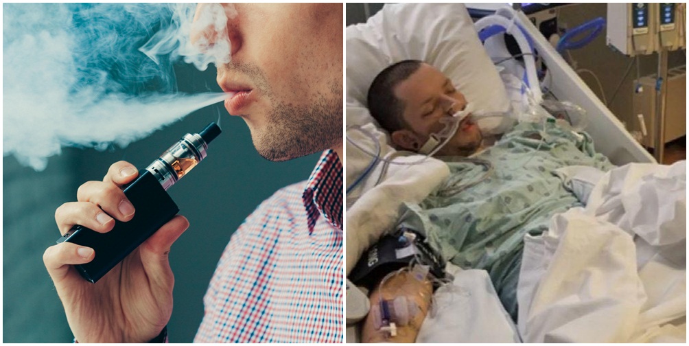 Sëmundja e shkaktuar nga cigaret elektronike/ Regjistrohen 215 raste, ndërron jetë personi i parë