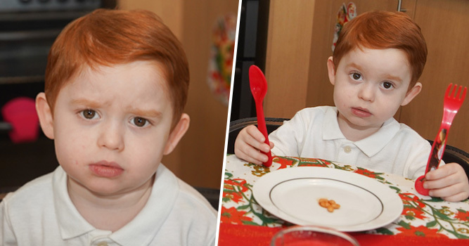 Dy vjeçari vuan nga sindroma e rrallë, s’mund të hajë më shumë se 5 fasule në vakt