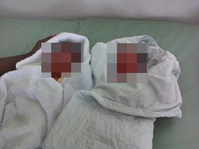 Tragjike! Vdesin foshnjet binjakë në Berat, çfarë ndodhi?