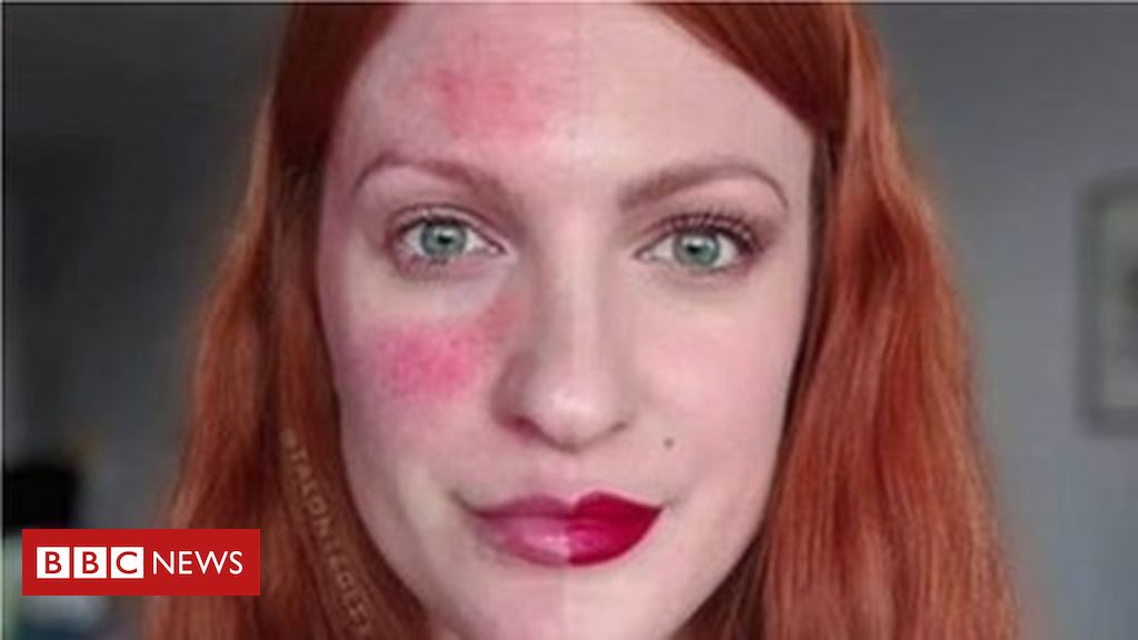 “Ke fytyrë të padëshirueshme”, Instagram i fshin foton modeles së veçantë