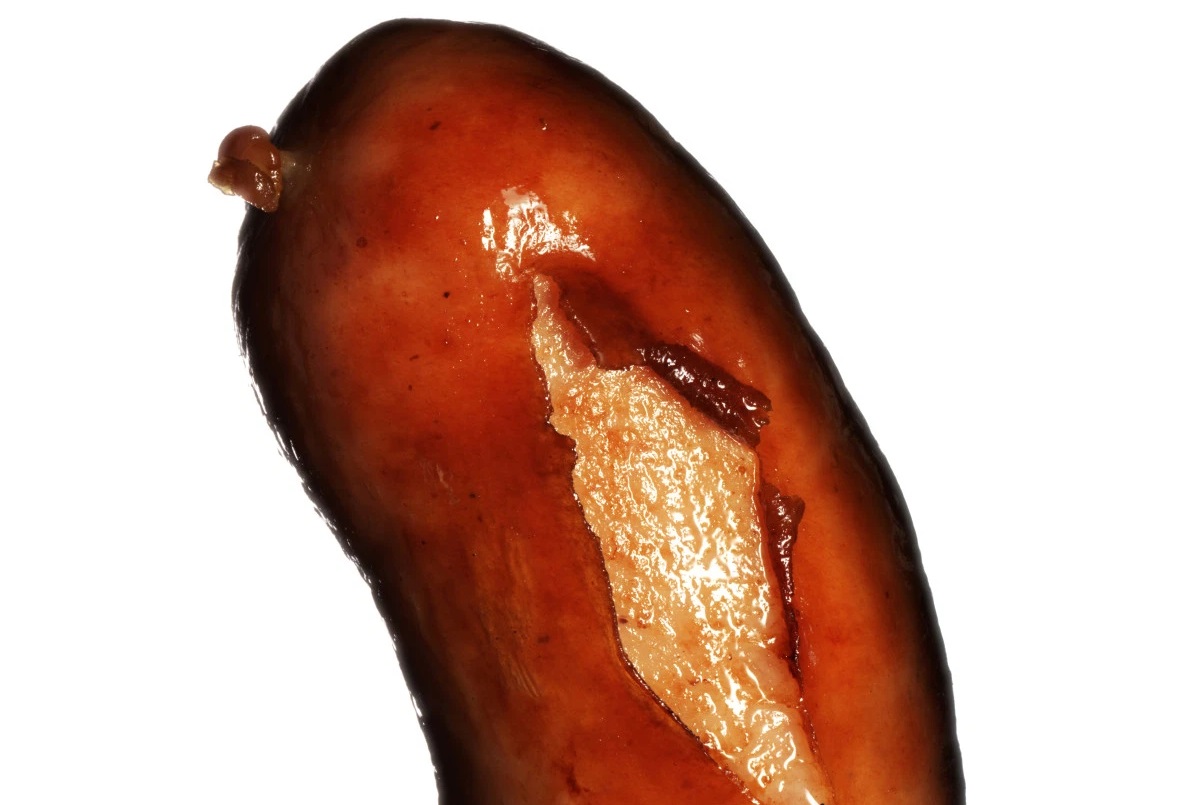 Çfarë është një penis i thyer dhe kur ndodh frakturimi i këtij organi?