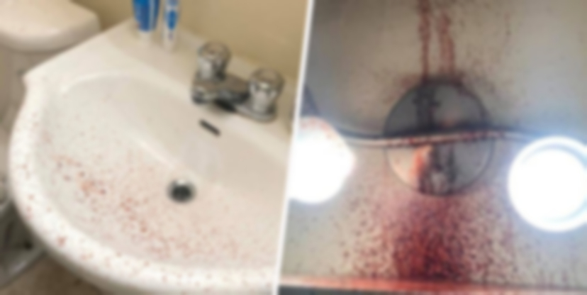 Tavani i tualetit kullon gjak, burri zbulon vdekjen tragjike të fqinjit