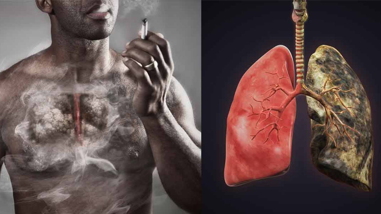 Mahniten edhe vetë studiuesit: Mushkëritë shërohen në mënyrë magjike pas lënies së duhanit
