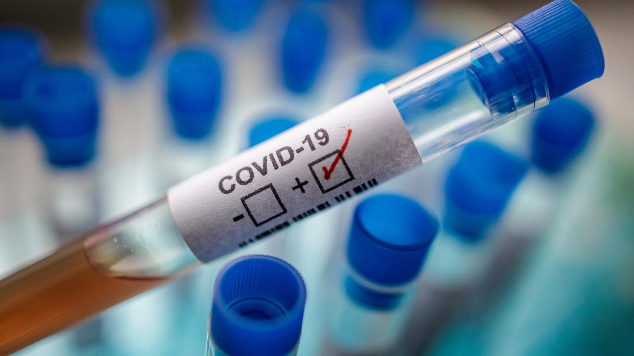 Spanjë/ U porositën miliona teste në Kinë, modeli i ri e dallon koronavirusin vetëm në ditën e pestë të infektimit