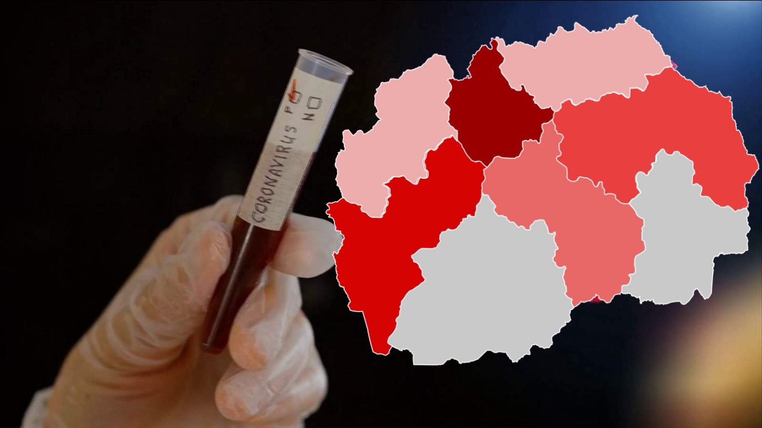 21 viktima dhe 444 të infektuar me COVID-19 në 24 orët e fundit në Maqedoni