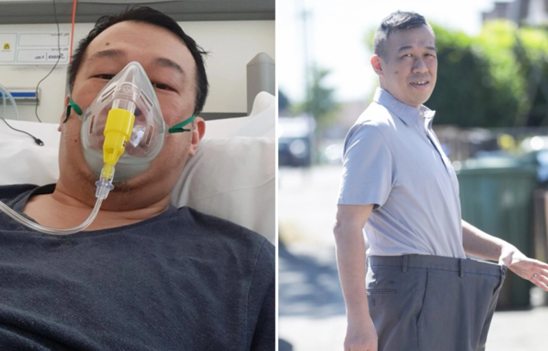 Pacienti humbet 32 kilogramë gjatë trajtimit kundër koronavirusit