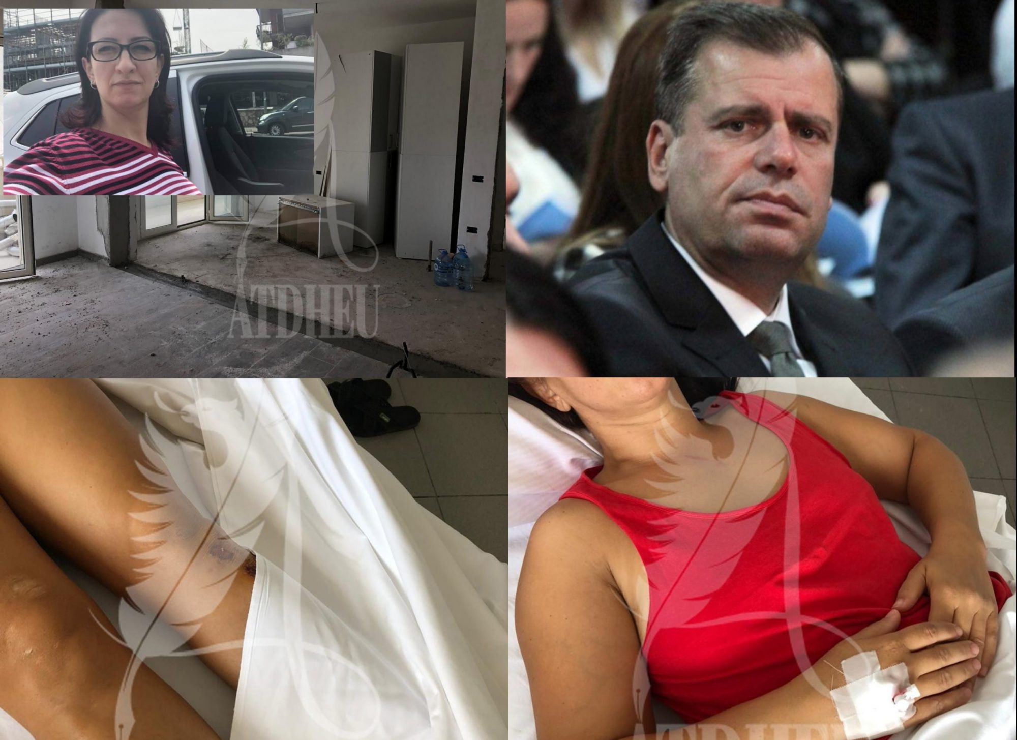 Dy gra rrihen barbarisht nga ish-gjyqtari Malaj dhe përfundojnë në spital me plagë, qytetarja: Më kanë marrë shtëpinë…