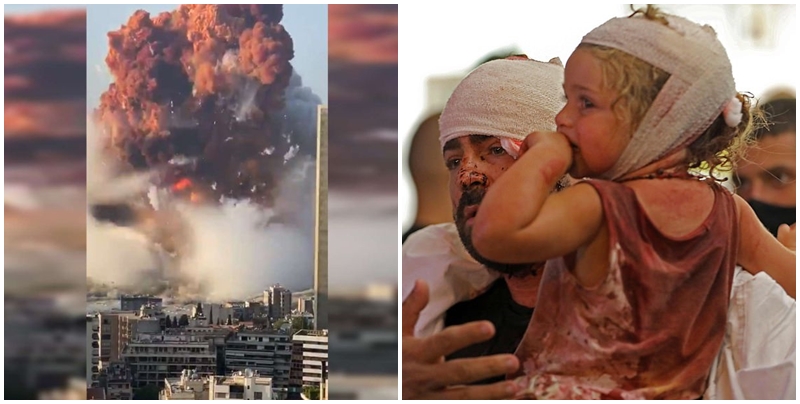 Ankth dhe lot në Liban/ Fëmijë dhe të rritur fotografohen të përgjakur pas tragjedisë