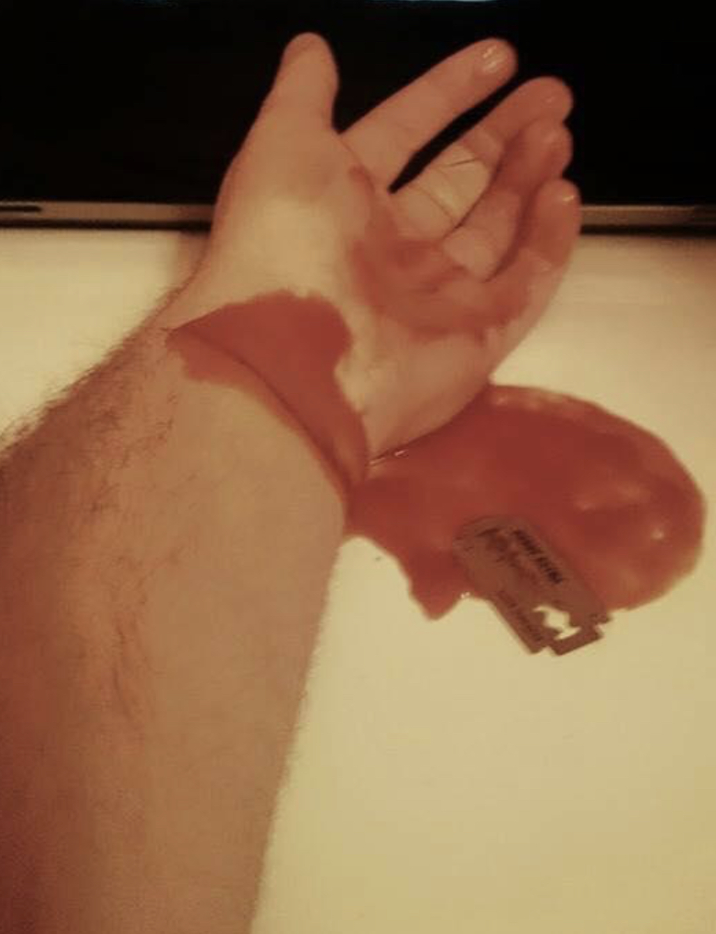 E rëndë në Tiranë/ 22-vjeçari pret damarët!