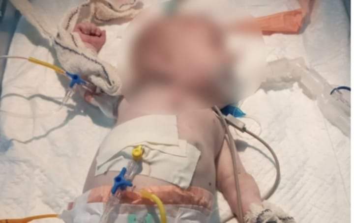 Bjordi nuk ia doli! Vdes fëmija 6 muajsh, për të cilin u kërkua ndihmë