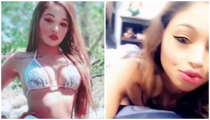 Shkoi të bënte vithet me silikon, vdes pornostarja 26-vjeçare