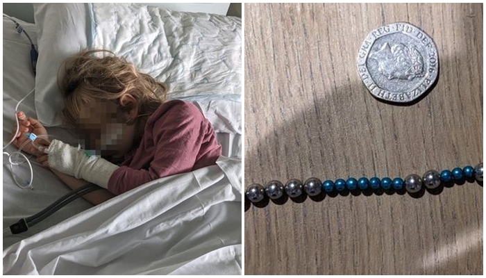 TikTok vë në rrezik jetën e vajzës 6-vjeçare që gëlltiti 23 magnetë për një sfidë ‘online’