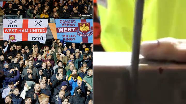 Pamje të rënda! Një tifoz humb gishtin gjatë ndeshjes mes West Ham dhe Genk