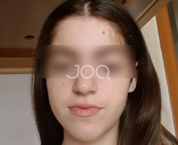 U raportua e zhdukur në JOQ, gjendet shëndoshë e mirë 17-vjeçarja nga Durrësi