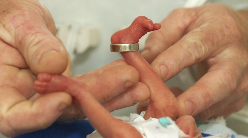 Peshonte vetëm 370 gramë, ndërhyrja e mjekëve italianë i shpëton jetën foshnjes “pupël”